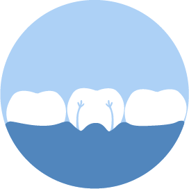 Endodoncia Dentistas Burgos