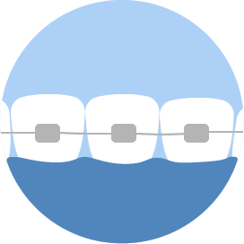 Ortodoncia Dentistas Burgos
